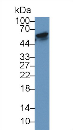 Monoclonal Antibody to Receptor Activator Of Nuclear Factor Kappa B (RANk)