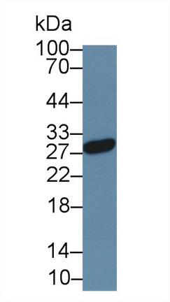 Monoclonal Antibody to Noggin (NOG)