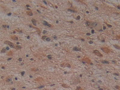 Monoclonal Antibody to Noggin (NOG)