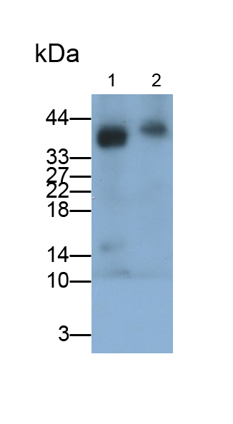 Monoclonal Antibody to HLA Class II Histocompatibility Antigen, DR Alpha Chain (HLA-DRA)