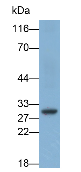 Monoclonal Antibody to HLA Class II Histocompatibility Antigen, DR Alpha Chain (HLA-DRA)
