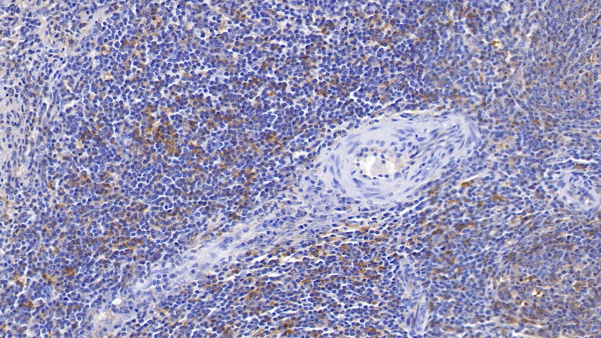 Monoclonal Antibody to HLA Class II Histocompatibility Antigen, DRB1 Beta Chain (HLA-DRB1)