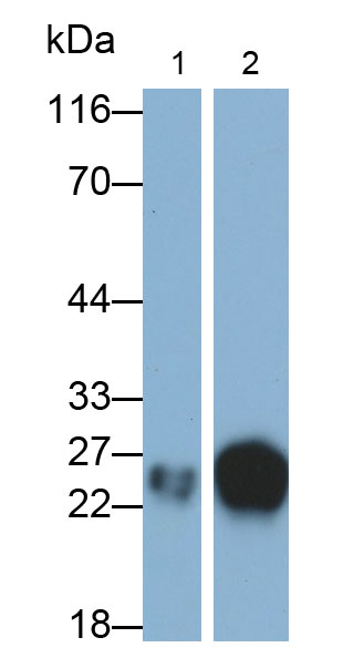 Monoclonal Antibody to HLA Class II Histocompatibility Antigen, DRB1 Beta Chain (HLA-DRB1)