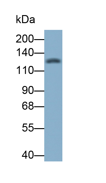 Monoclonal Antibody to Tropomyosin Receptor Kinase B (TrkB)