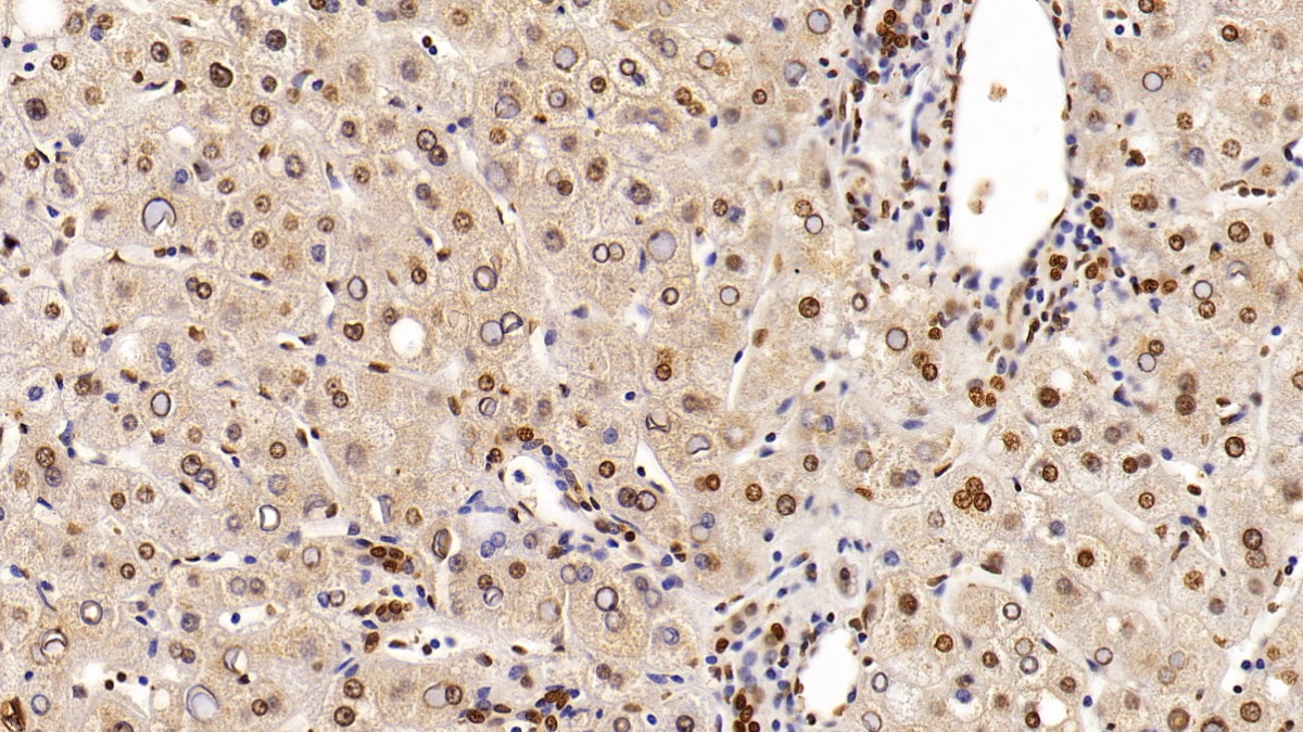 Monoclonal Antibody to Histone Deacetylase 1 (HDAC1)