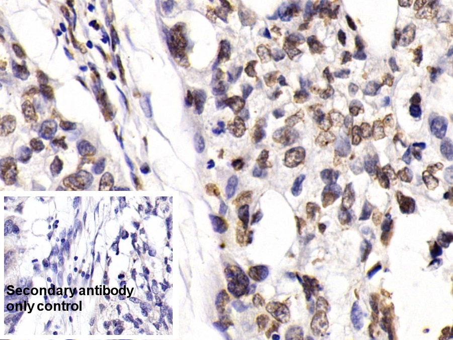 Monoclonal Antibody to Histone Deacetylase 1 (HDAC1)