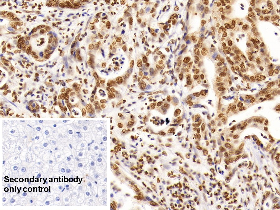 Monoclonal Antibody to Histone Deacetylase 1 (HDAC1)