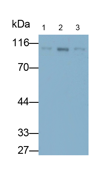 Monoclonal Antibody to Promyelocytic Leukemia Protein (PML)
