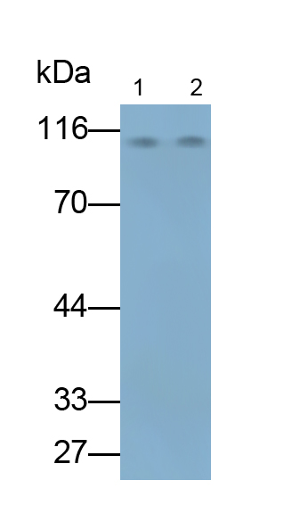 Monoclonal Antibody to Promyelocytic Leukemia Protein (PML)