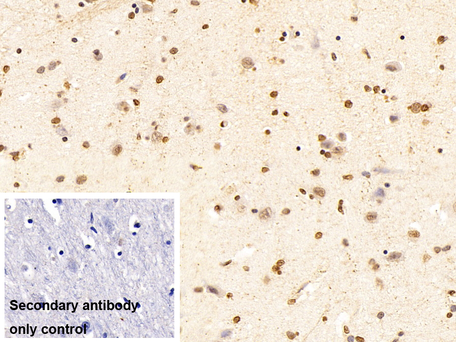 Monoclonal Antibody to Promyelocytic Leukemia Protein (PML)