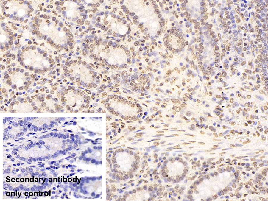 Monoclonal Antibody to Promyelocytic Leukemia Protein (PML)
