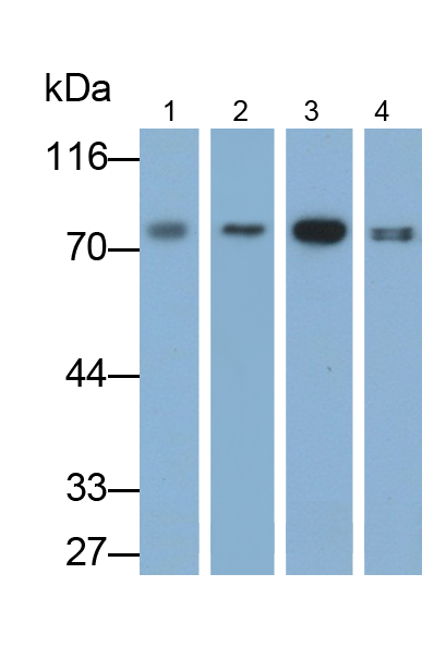 Monoclonal Antibody to Zyxin (ZYX)