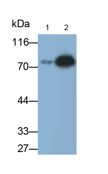 Monoclonal Antibody to Zyxin (ZYX)