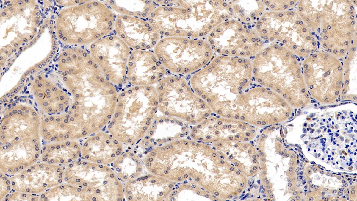 Monoclonal Antibody to Allograft inflammatory factor 1 (AIF1)