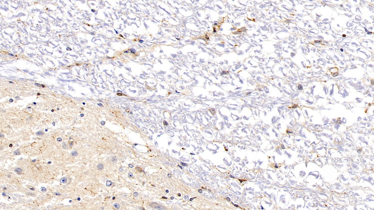 Monoclonal Antibody to Allograft inflammatory factor 1 (AIF1)