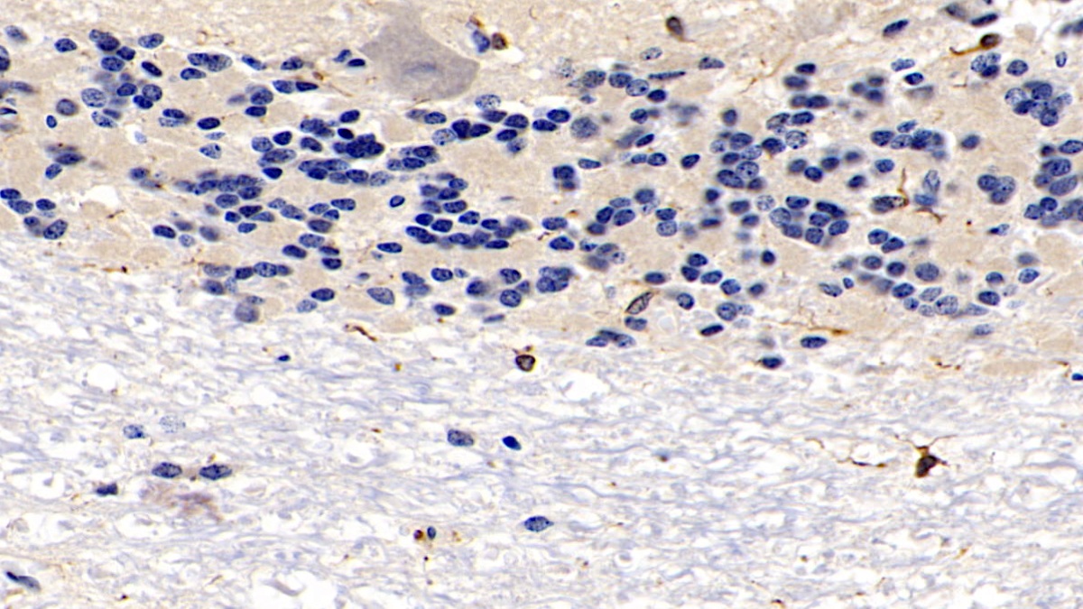 Monoclonal Antibody to Allograft inflammatory factor 1 (AIF1)
