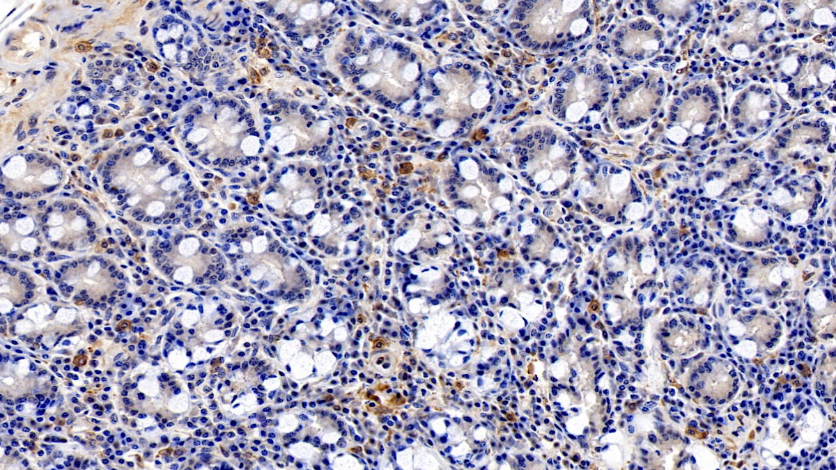 Monoclonal Antibody to Allograft inflammatory factor 1 (AIF1)