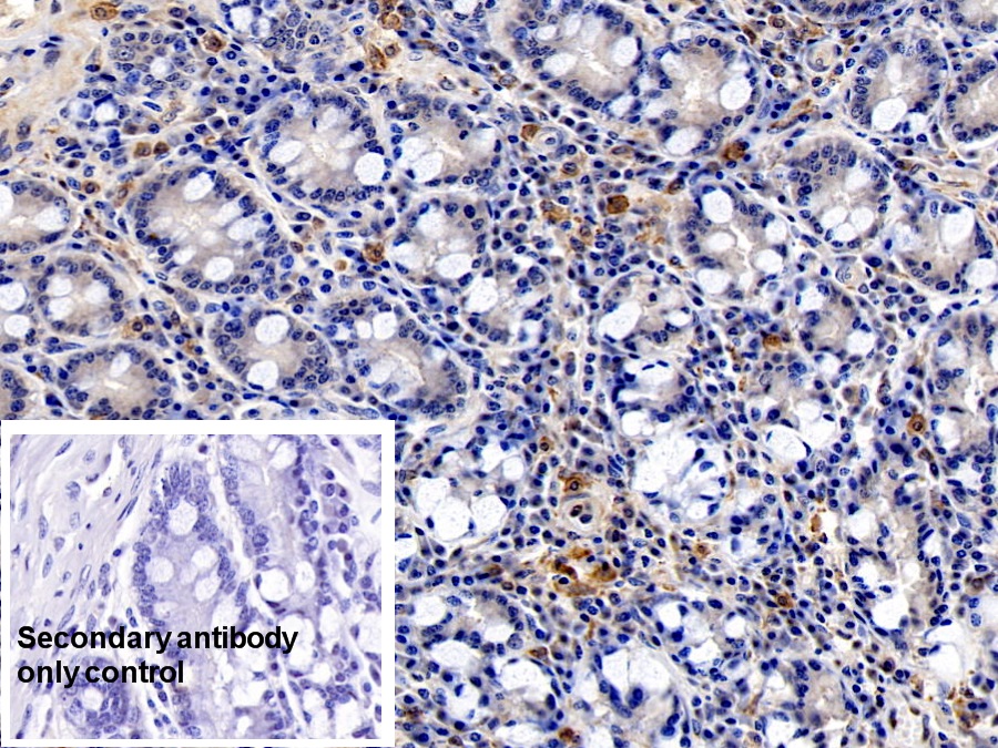 Monoclonal Antibody to Allograft inflammatory factor 1 (AIF1)