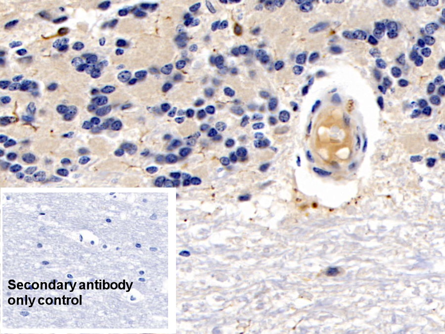 Monoclonal Antibody to Allograft inflammatory factor 1 (AIF1)