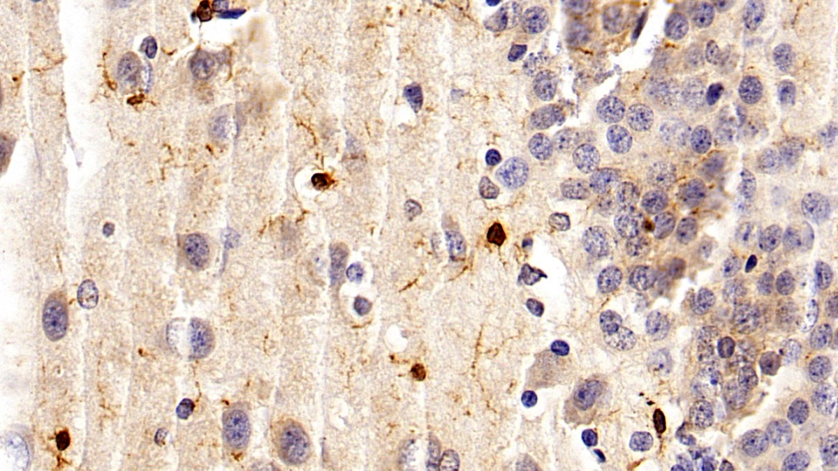 Monoclonal Antibody to Allograft inflammatory factor 1 (AIF1)
