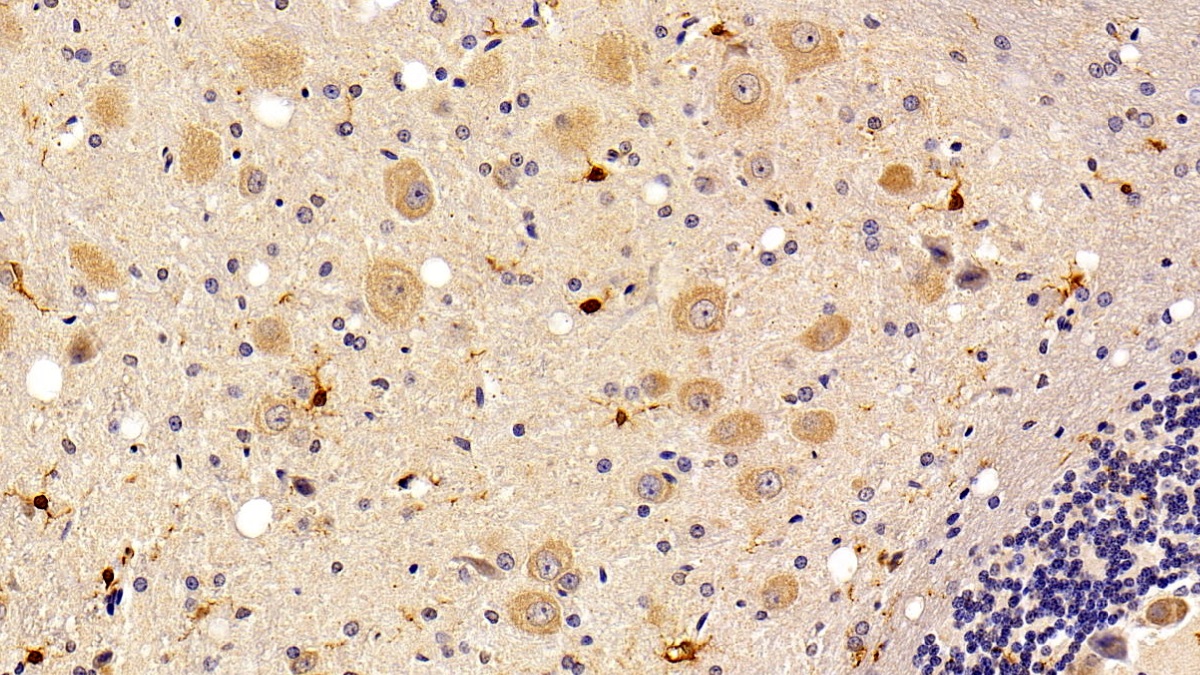 Monoclonal Antibody to Allograft inflammatory factor 1 (AIF1)