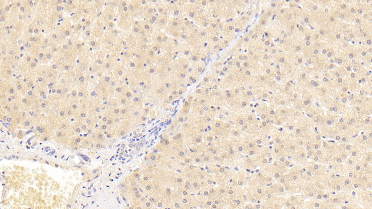 Monoclonal Antibody to Antithrombin (AT)