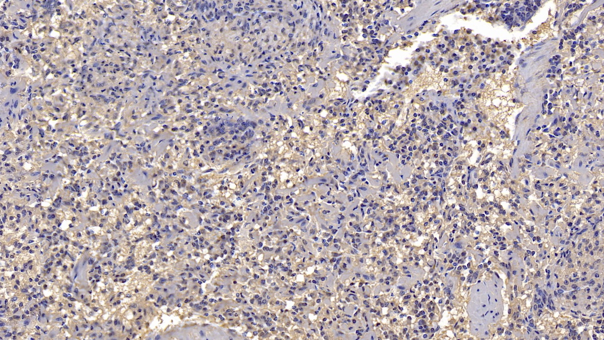 Monoclonal Antibody to Antithrombin (AT)