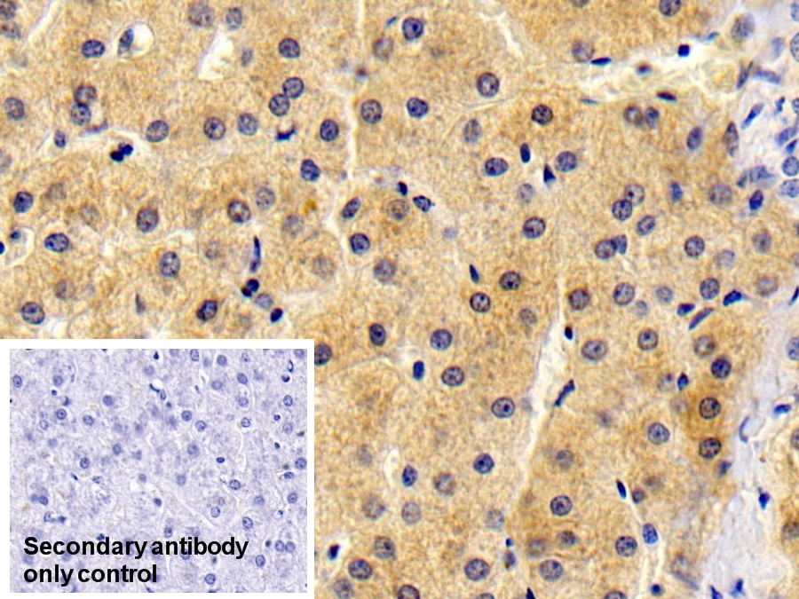 Monoclonal Antibody to Antithrombin (AT)