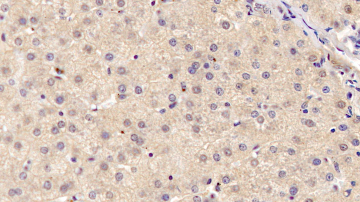 Monoclonal Antibody to Antithrombin (AT)