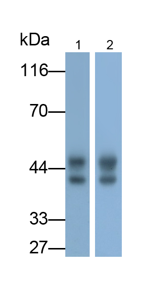 Monoclonal Antibody to Argininosuccinate Synthetase 1 (ASS1)