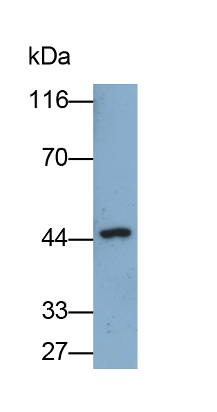 Monoclonal Antibody to Argininosuccinate Synthetase 1 (ASS1)