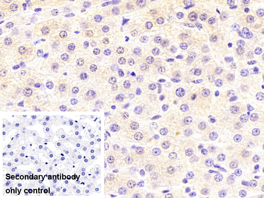 Monoclonal Antibody to Argininosuccinate Synthetase 1 (ASS1)