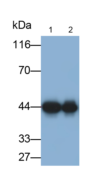 Monoclonal Antibody to Argininosuccinate Synthetase 1 (ASS1)