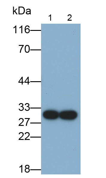 Monoclonal Antibody to Carbonyl Reductase 1 (CBR1)