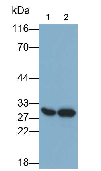 Monoclonal Antibody to Carbonyl Reductase 1 (CBR1)