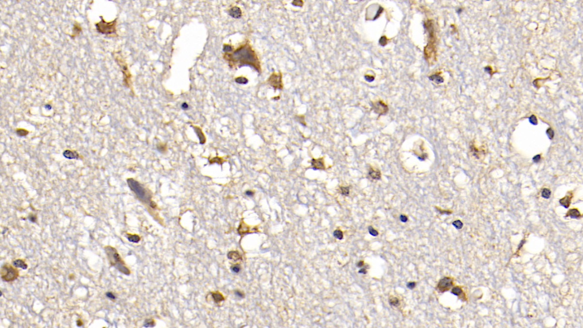 Monoclonal Antibody to Fibroblast Activation Protein Alpha (FAPa)