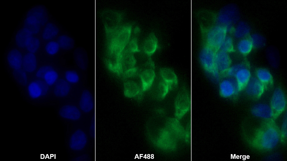 Monoclonal Antibody to Ferroportin (FPN)