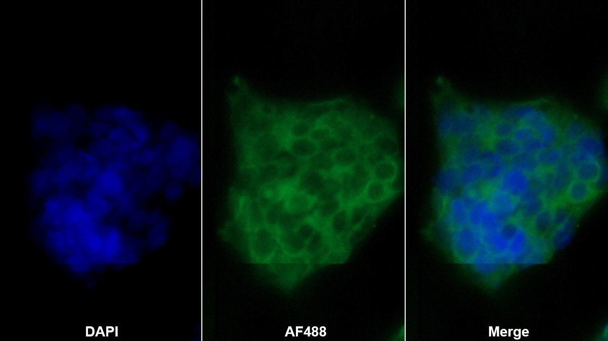 Monoclonal Antibody to Ferroportin (FPN)