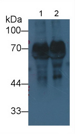 Monoclonal Antibody to Histidine Rich Glycoprotein (HRG)