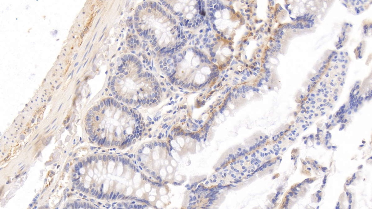 Monoclonal Antibody to Histidine Rich Glycoprotein (HRG)