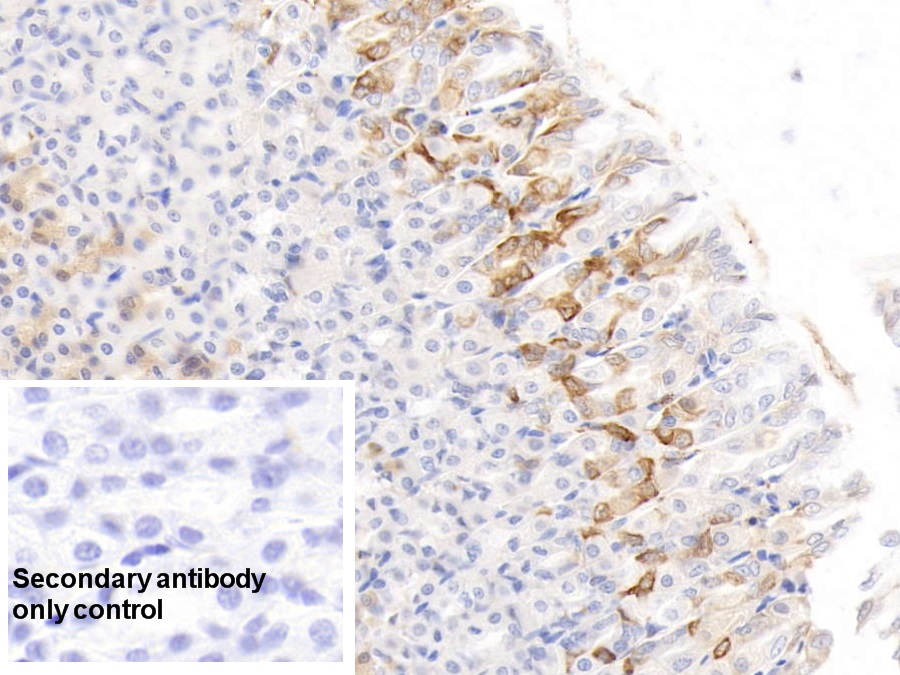 Monoclonal Antibody to Histidine Rich Glycoprotein (HRG)