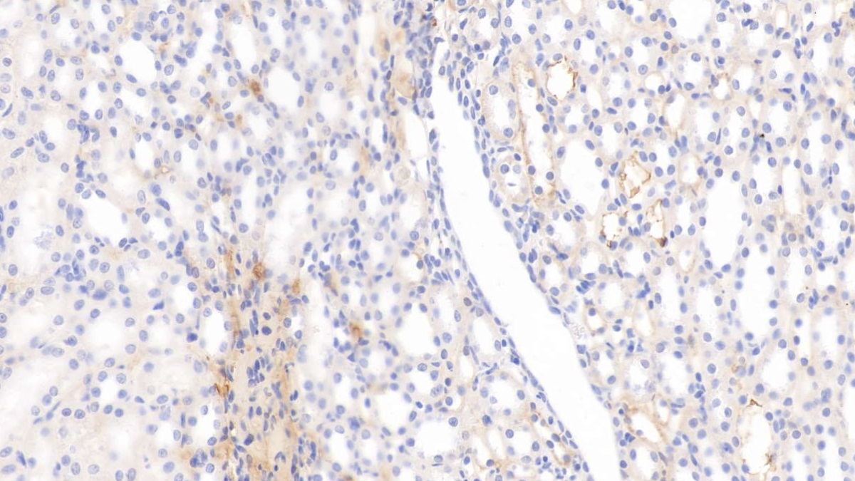 Monoclonal Antibody to Histidine Rich Glycoprotein (HRG)