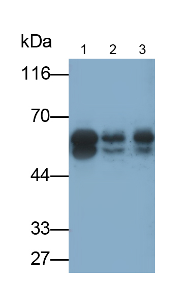 Monoclonal Antibody to Islet Cell Autoantigen 1 (ICA1)
