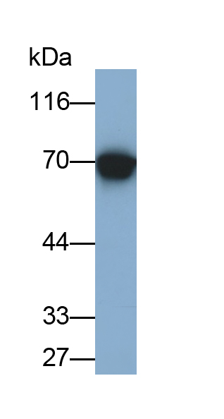 Monoclonal Antibody to L-Plastin (LCP1)