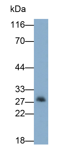 Monoclonal Antibody to Mitochondrial Uncoupling Protein 2 (UCP2)