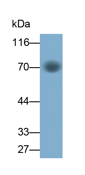 Monoclonal Antibody to Perilipin 1 (PLIN1)
