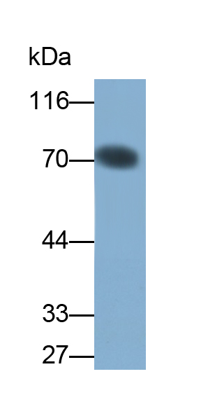 Monoclonal Antibody to Perilipin 1 (PLIN1)