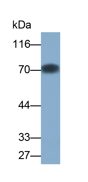 Monoclonal Antibody to Perilipin 1 (PLIN1)