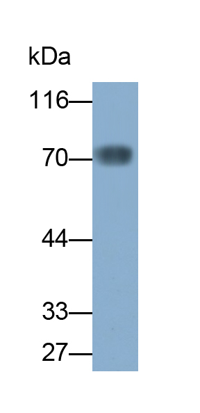 Monoclonal Antibody to Perilipin 1 (PLIN1)