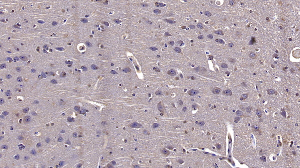 Monoclonal Antibody to Reelin (RELN)